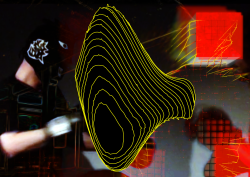 syndrome_2_1_2